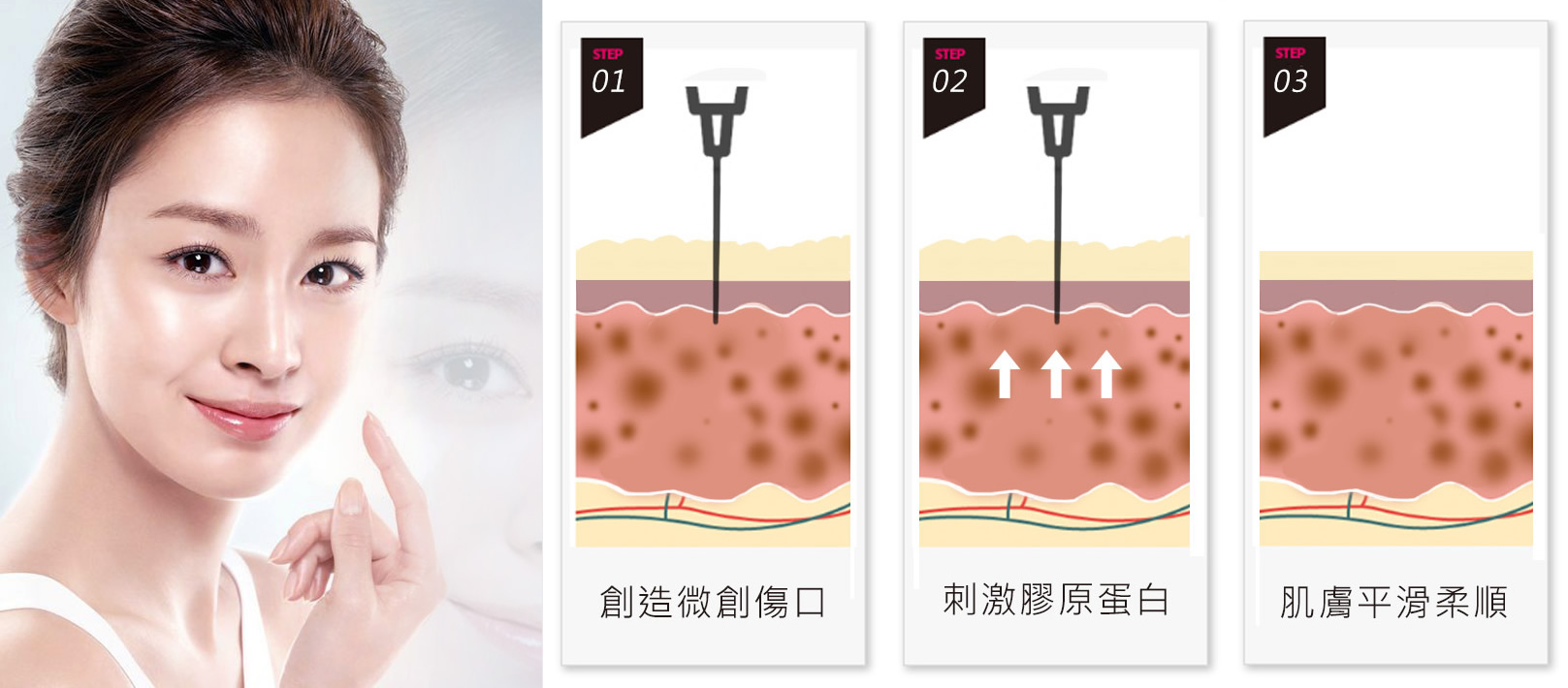 韓后醫美 韓國皮膚管理：創造為創傷口、刺激膠原蛋白、肌膚平滑柔順。