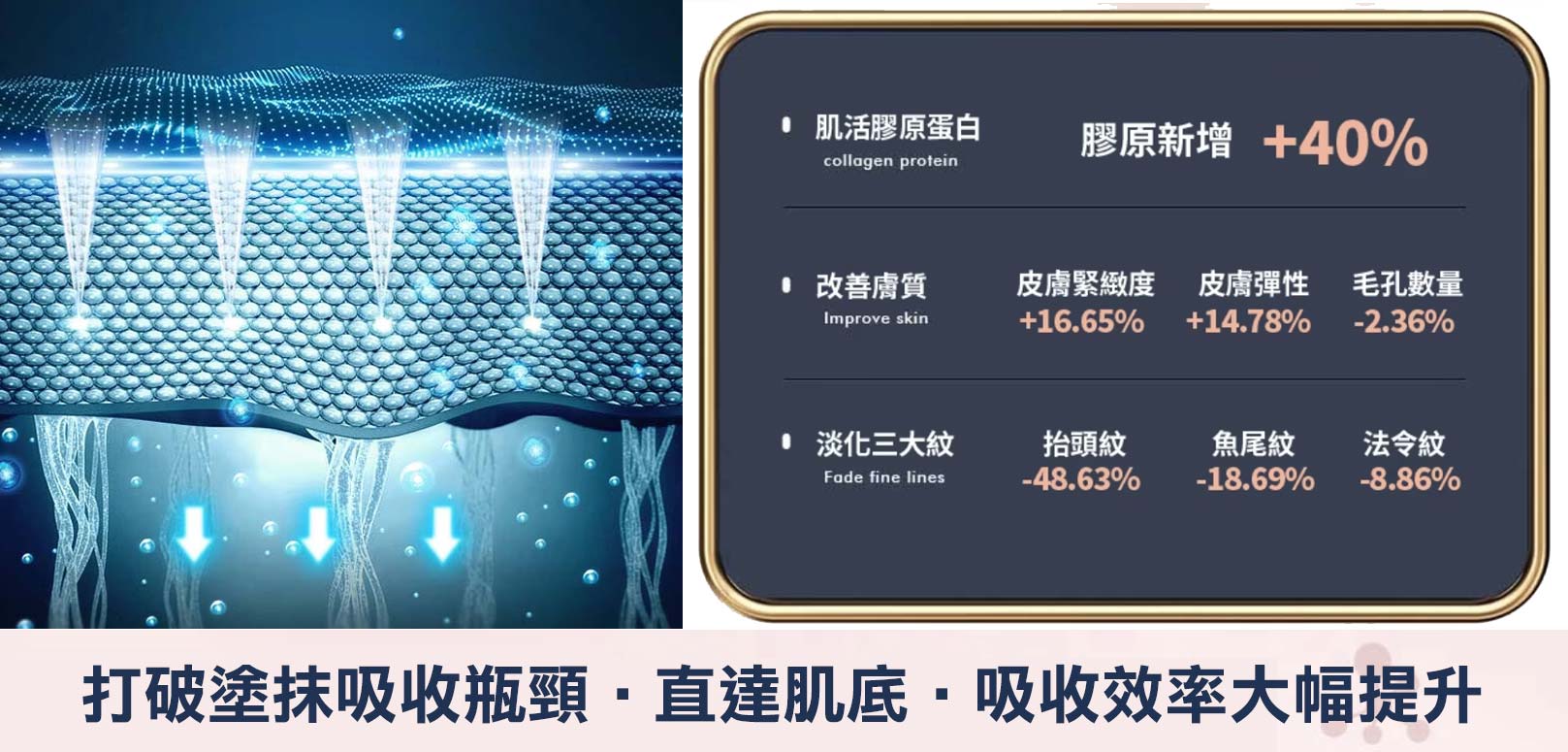 奈米晶片水光深導,打破塗抹吸收瓶頸，直達肌底，吸收效率大幅提升。肌活膠原蛋白：膠原新增+40%。改善膚質：皮膚緊緻度+16.65%、皮膚彈性+14.78%、毛孔數量-2.36%。淡化三大紋：抬頭紋-48.63%、魚尾纹-18.69%、法令紋-8.86%。韓后醫美,韓國皮膚管理,術後管理