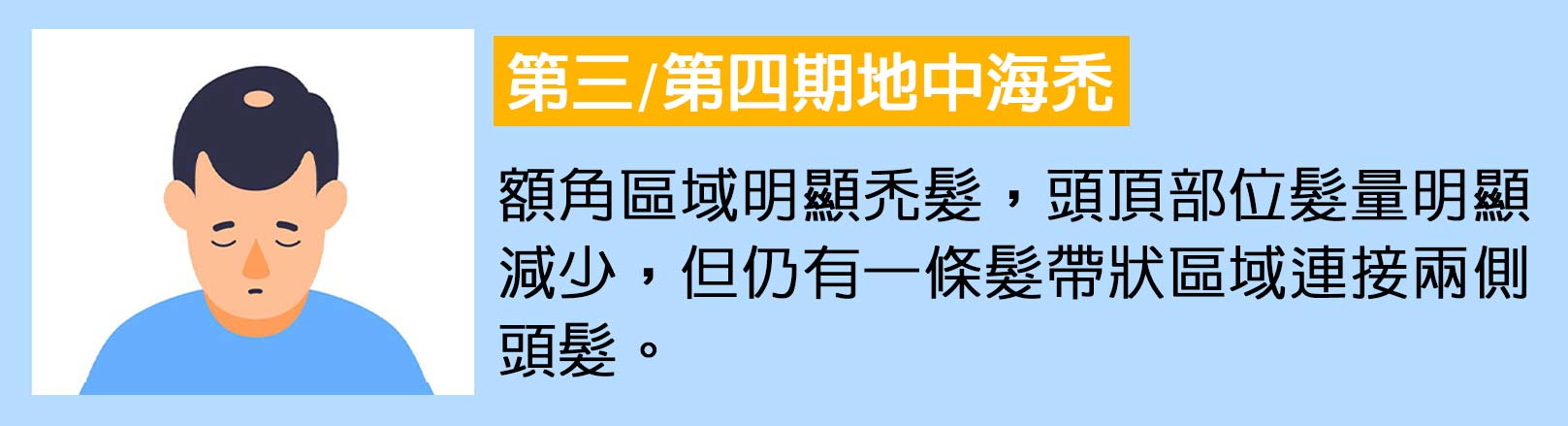 第三/四期地中海禿：額角區域明顯禿髮，頭頂部位髮量明顯減少，但仍有一條髮帶狀區域連接兩側頭髮。韓后醫美