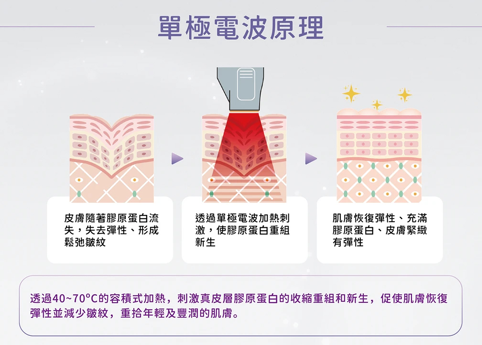 韓后醫美,十倍電波,十蓓電波,電波的原理：十倍電波就像個溫暖的魔法師，用它的高頻交流電輕輕進入肌膚的深層，像是在真皮層裡施展了一場40°C~70°C的熱能魔法。這股熱力不僅讓皺紋開始變淡，肌膚也變得越來越緊緻。最棒的是，這位魔法師的法力還不會馬上消失，做完療程後，這份緊緻感能持續下去，讓肌膚一天比一天更有彈性！