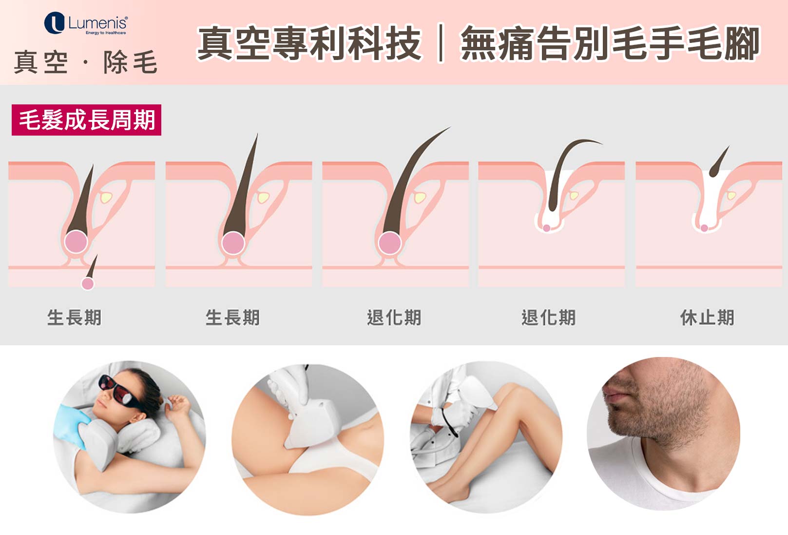 LightSheer 真空除毛適用部位：腋下,背部,腹部,胸部,大小腿,鬍鬚,乳暈,髮際線,手/腳趾,私密處/比基尼線。韓后醫美