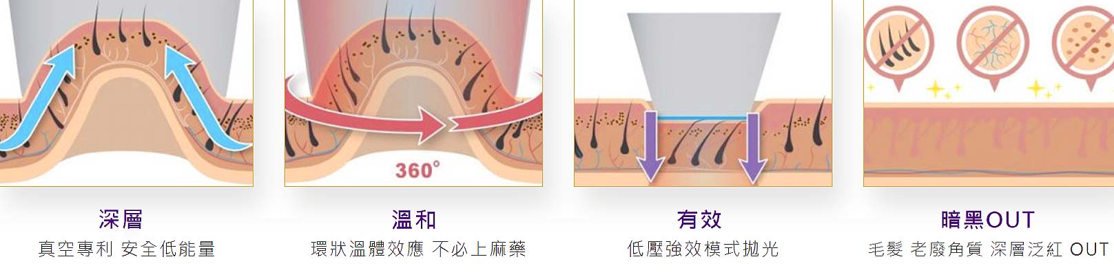 LightSheer真空除毛｜1.更深層：HITM真空專利安全低能量。2.更温和：360度環狀溫體效應不必上麻藥。3.更有效：Chill Tip TM冷模式抛光。4.暗黑OUT：毛髮、老廢角質、暗沉泛紅OUT!。韓后醫美