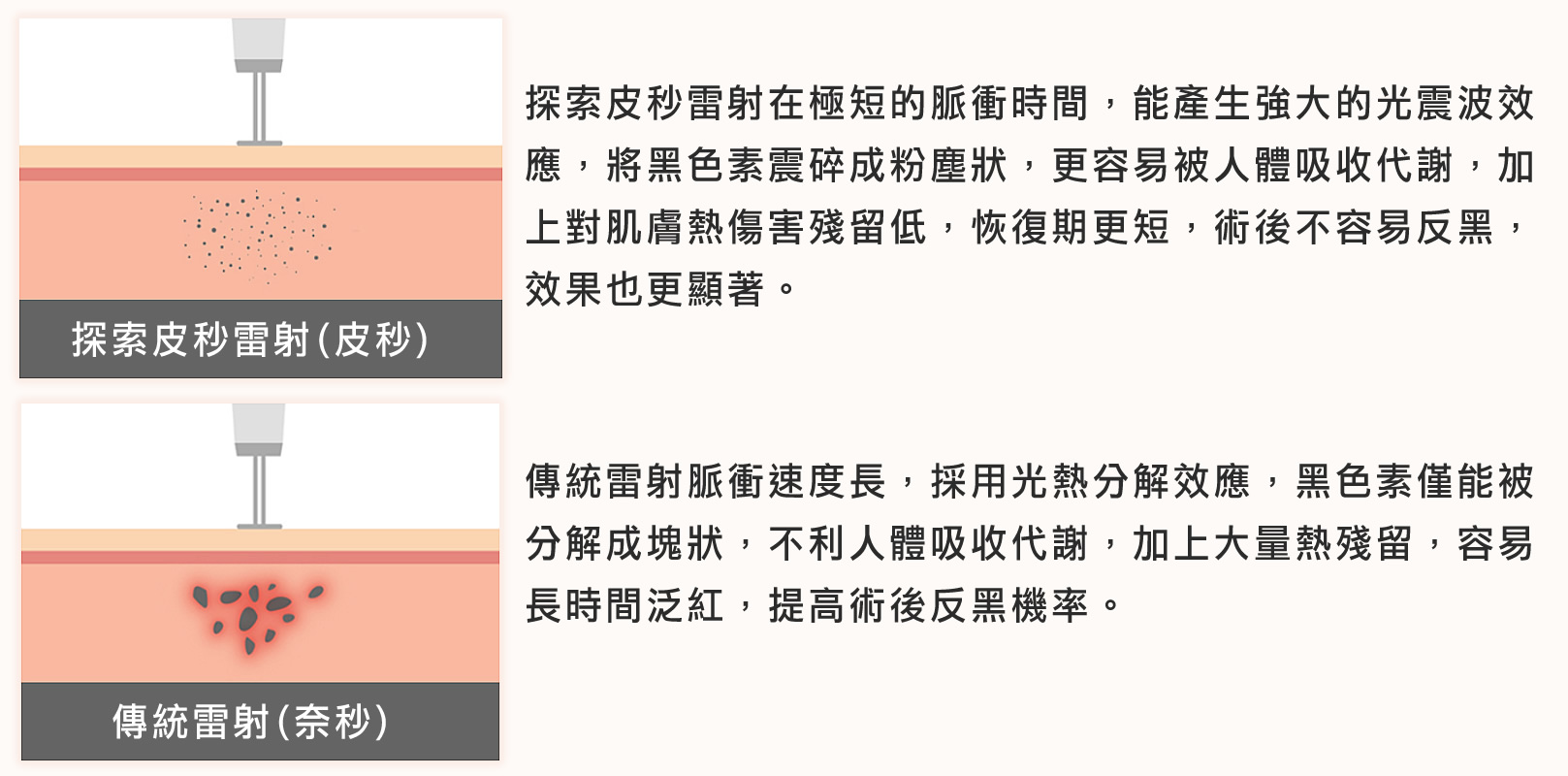 探索皮秒雷射（皮秒）：探索皮秒雷射在極短的脈衝時間，能產生強大的光震波效應，將黑色素震碎成粉塵狀，更容易被人體吸收代謝，加上對肌膚熱傷害殘留低，恢復期更短，術後不容易反黑，效果也更顯著。傳統雷射（奈秒）：傳統雷射脈衝速度長，採用光熱分解效應，黑色素僅能被分解成塊狀，不利人體吸收代謝，加上大量熱殘留，容易長時間泛紅，提高術後反黑機率。