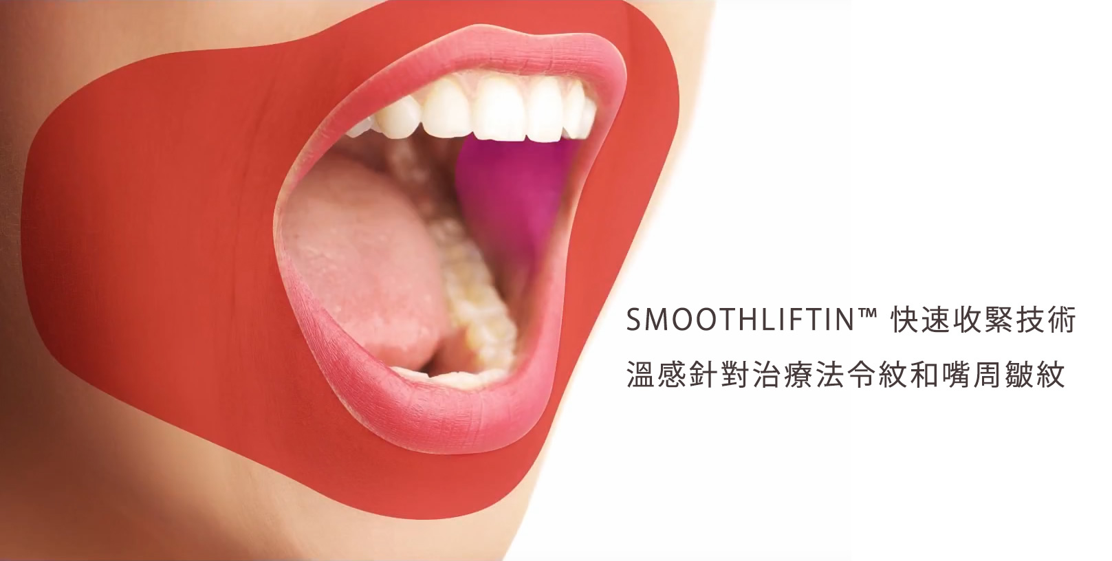 韓后醫美 4D口內拉提 SmoothLiftin™ 快速收緊技術，溫感針對治療法令紋和嘴周皺紋。