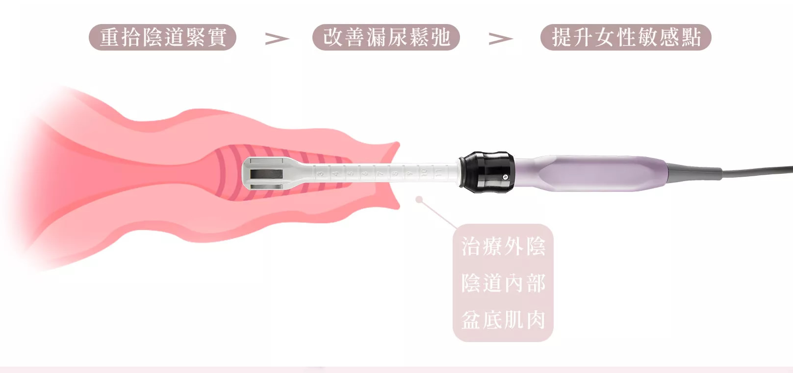 韓后醫美 FORMA V 蝴蝶電波 私密處雷射