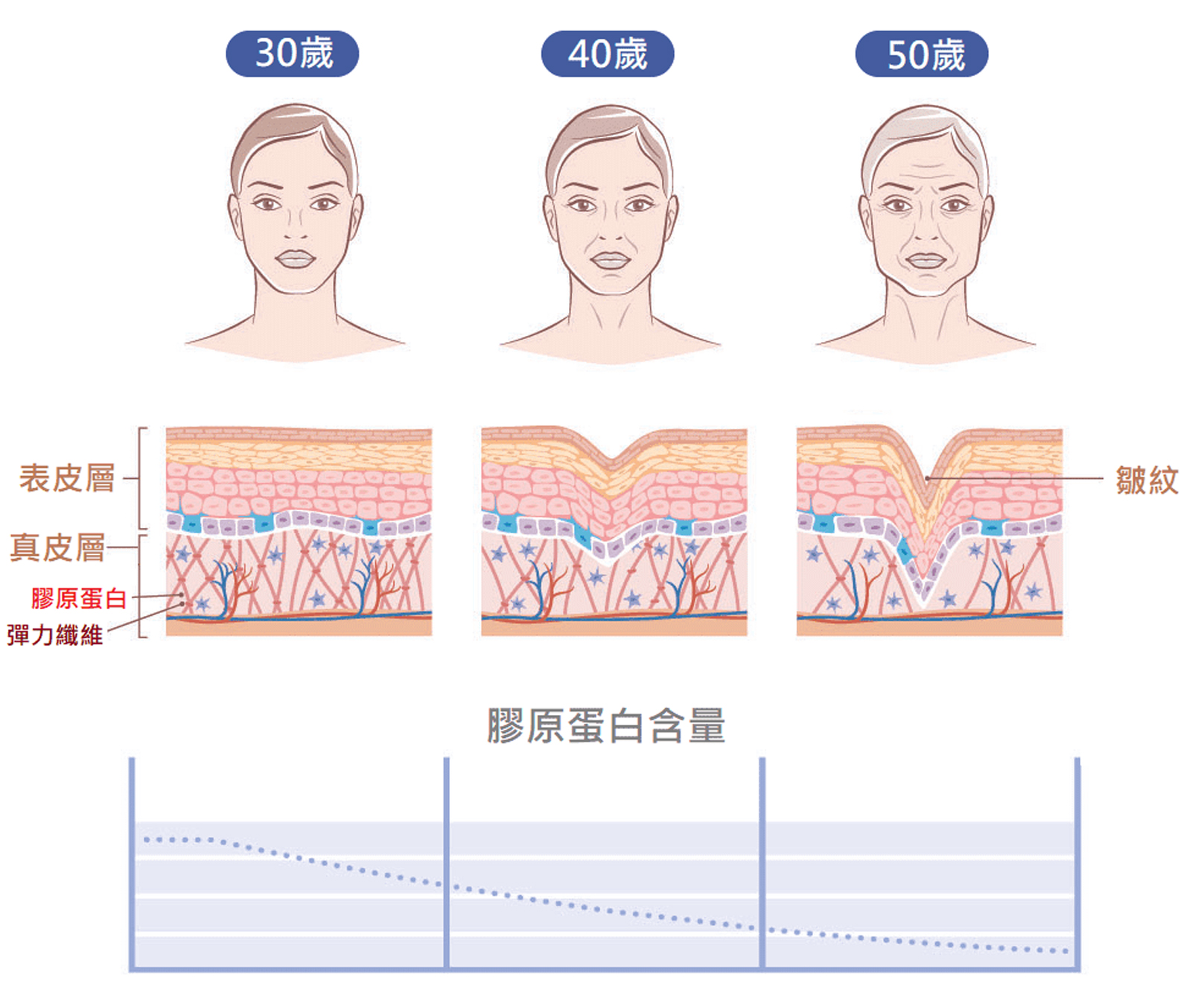 韓后醫美 艾麗斯,Aesthefill,精靈針,全新一代,聚雙旋乳酸,百變,速溶,自然,安全