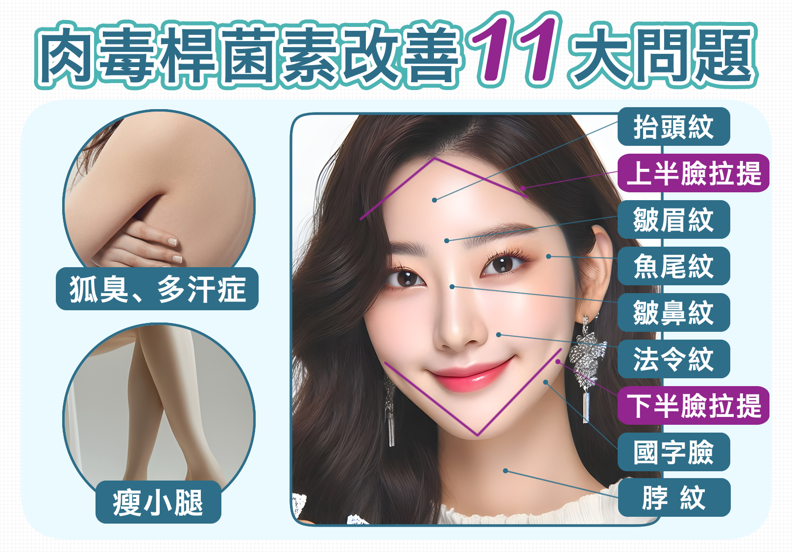 韓后醫美 Botox 撫平動態紋路、改善多汗症狐臭、阻斷小腿神經、消除咀嚼肌肥大。