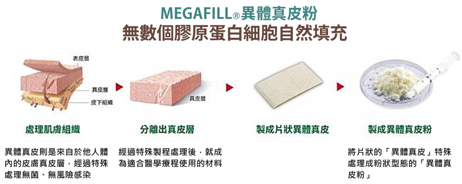 韓后醫美,美佳膚MegaFill異體真皮粉