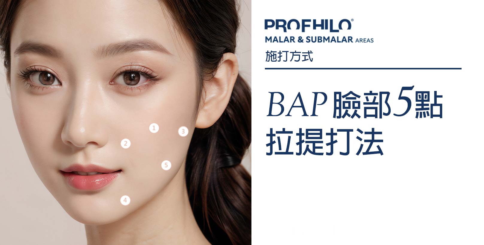BAP五點拉提：Profhilo逆時針在注射至真皮層後，可自然地融合於組織，並重建皮膚水分平衡。因此無論是臉部、頸部、手部，或是更廣泛的身體部位，甚至乾癬、燒燙傷等受損的肌膚組織都能受益於逆時針的肌膚再生效果。Profhilo,逆時針,韓后醫美