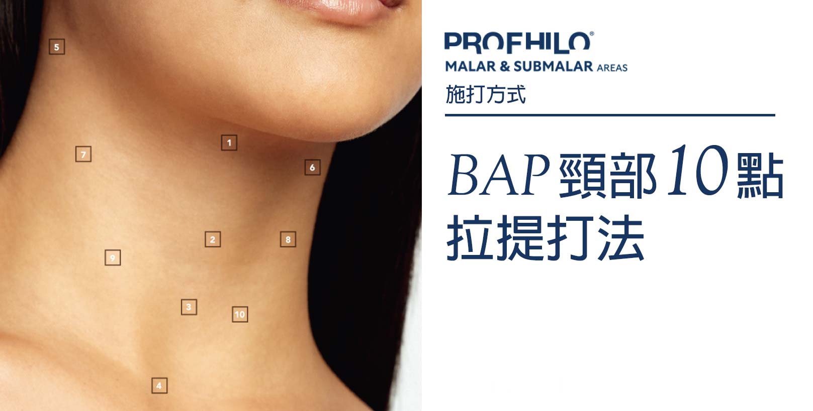 BAP頸部10點拉提：頸部是肌膚老化最容易顯現的區域之一，不僅易有橫向的脖紋產生，也常出現鬆弛（俗稱「火雞脖」）和膚質粗糙乾裂等問題。Profhilo,逆時針,韓后醫美