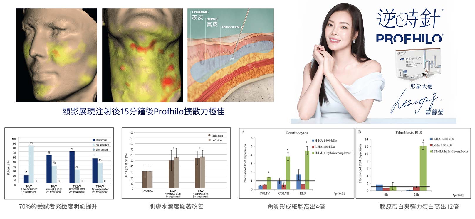 Profhilo逆時針,顯影展現注射後15分鐘後Profhilo擴散力極佳,韓后醫美