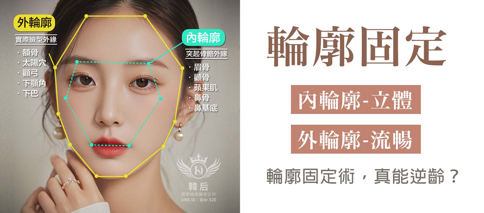輪廓固定術,真能逆齡?外輪廓(流暢)-實際臉型外緣:額骨,太陽穴,顴弓,下顎角,下巴。内輪廓(立體)-突起骨骼外緣:眉骨,顴骨,蘋果肌,鼻骨,鼻基底。韓后醫美