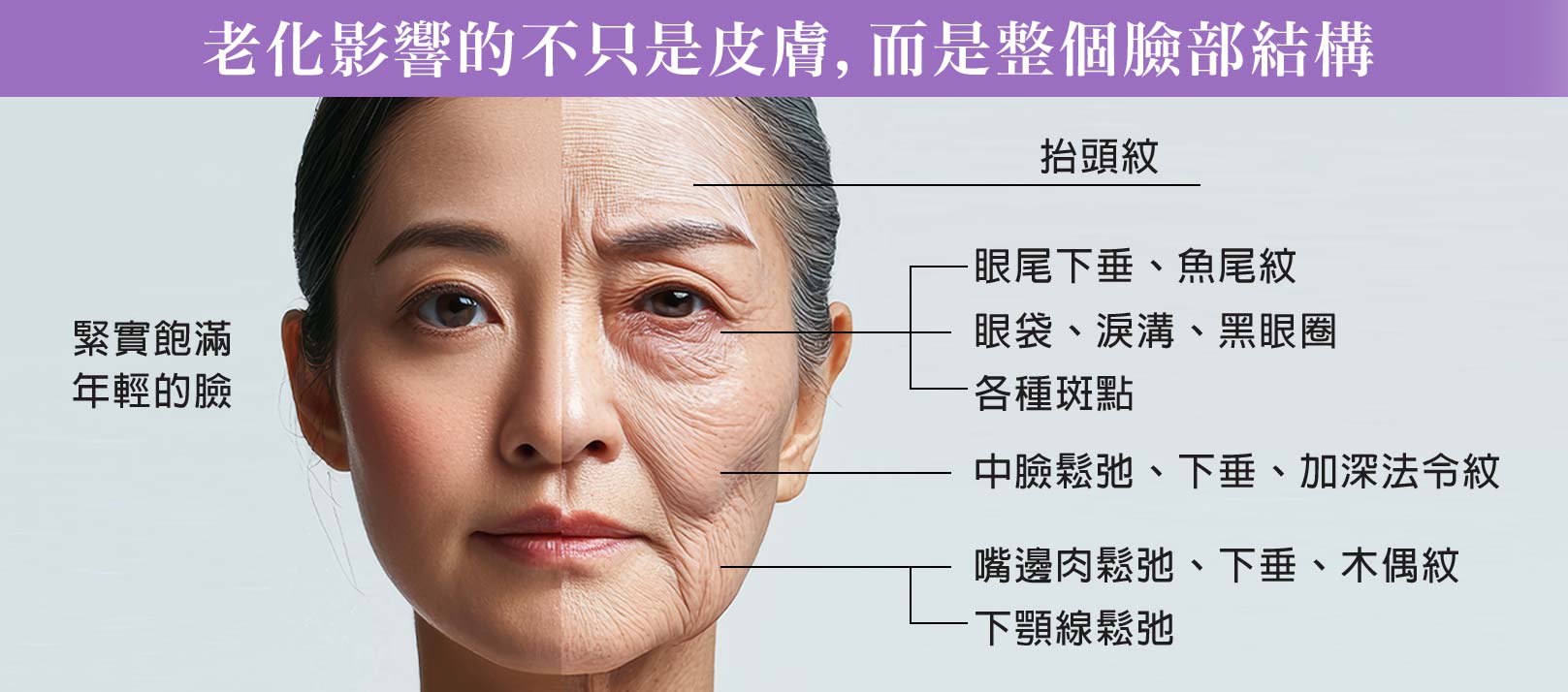 輪廓固定術,老化影響的不只是皮膚,而是整個臉部結構。緊實飽滿年輕的臉,老化的臉-抬頭紋,眼尾下垂,魚尾紋,眼袋,淚溝,黑眼圈,各種斑點,中臉鬆弛,下垂,加深法令紋,嘴邊肉鬆弛下垂,木偶紋,下顎線鬆弛。韓后醫美