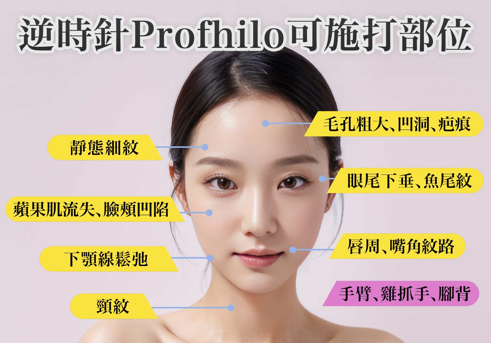 逆時針Profhilo可施打部位：静態細紋、蘋果肌流失、臉頰凹陷、下顎線鬆弛、頸紋、毛孔粗大、凹洞、疤痕、眼尾下垂、魚尾紋、唇周、嘴角紋路、手臂、雞抓手、腳背等。韓后醫美