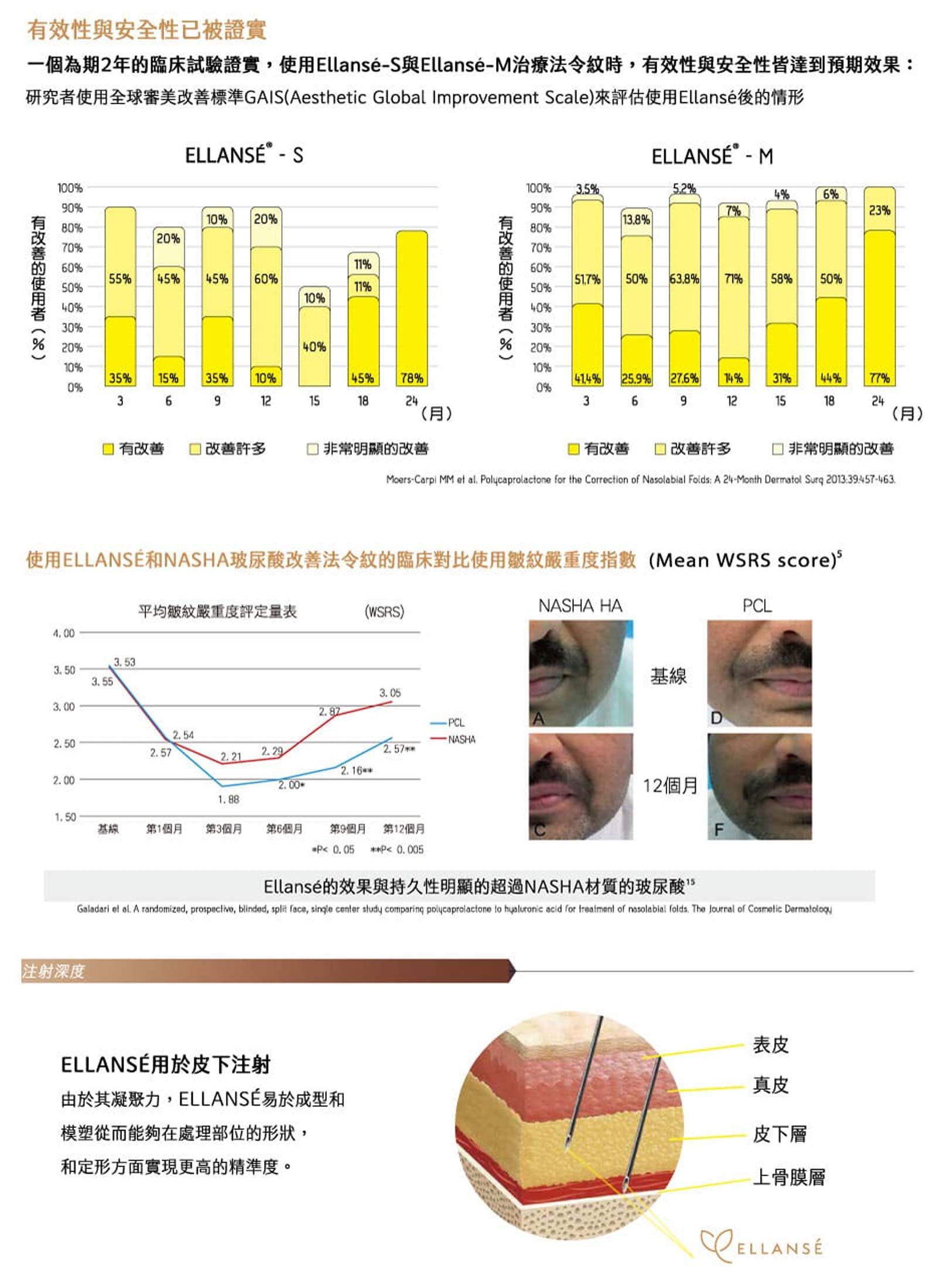 EllANSÉ 洢蓮絲,韓后醫美,PCL晶球,長效持久,立即填充,效果自然,口碑好評,高度滿意,撫平皺紋