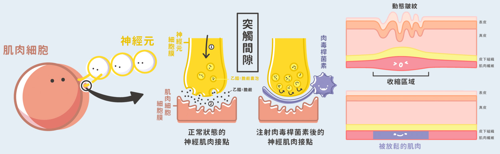 韓后醫美 Botox 自拍零死角：改善 皺眉紋、魚尾紋、抬頭紋、咀嚼肌、瘦小臉、國字臉、蘿蔔腿、腋下止汗。