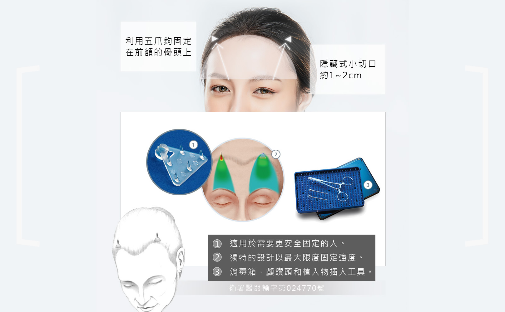 韓后醫美 內視鏡拉提上臉（前額）：改善抬頭紋及眼皮眼角下垂。